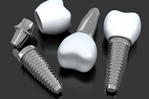 Three animated dental implants